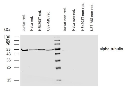 Anti-alpha-Tubulin Monoclonal Antibody (Clone: YOL1/34)